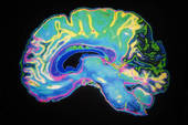 affordable therapy toronto brain
